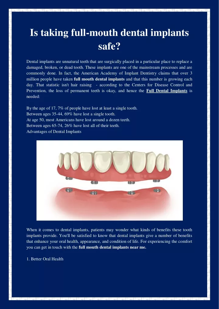 is taking full mouth dental implants safe