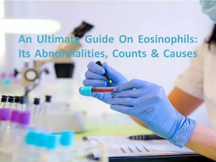 an ultimate guide on eosinophils its abnormalities counts causes