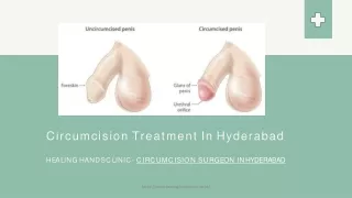 Circumcision Hospital in Hyderabad - Circumcision operation in Hyderabad