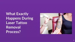 What Exactly Happens During Laser Tattoo Removal Process