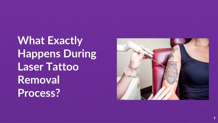 what exactly happens during laser tattoo removal process