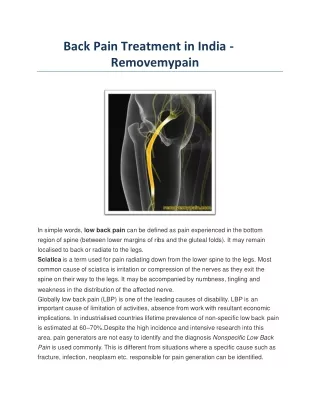 Back Pain Treatment in India - Removemypain-converted