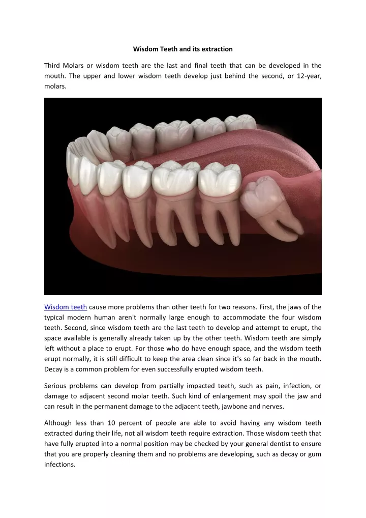 wisdom teeth and its extraction