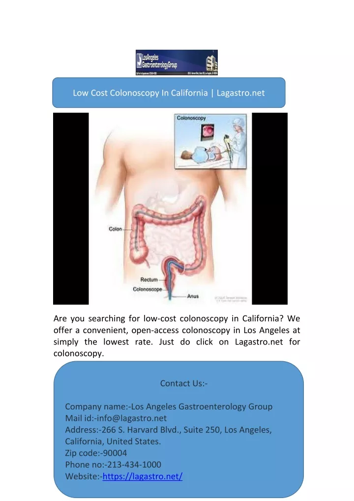 low cost colonoscopy in california lagastro net