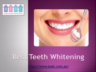 best teeth whitening