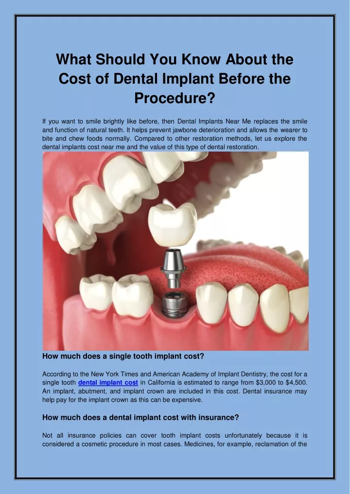 what should you know about the cost of dental