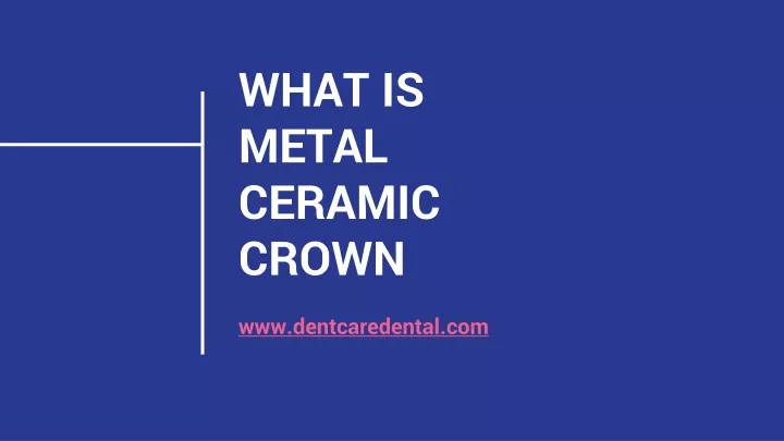 what is metal ceramic crown