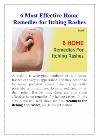 6 most effective home remedies for itching rashes
