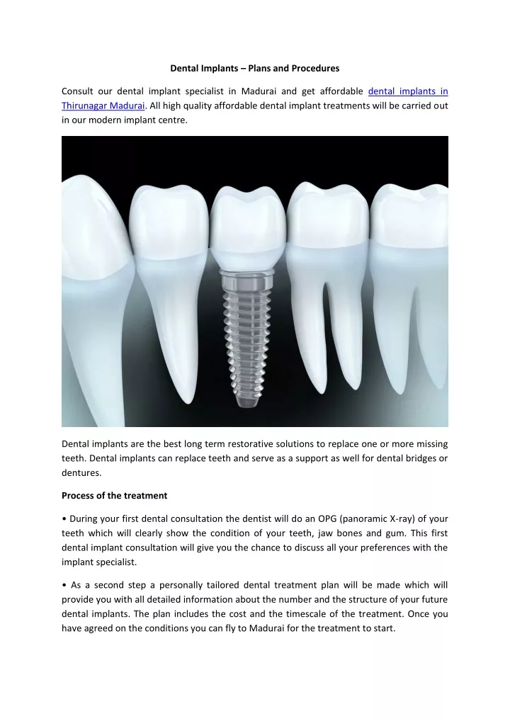 dental implants plans and procedures