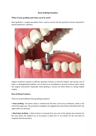 Bone grafting procedure | Dental Hospital in Madurai