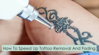 How To Speed Up Tattoo Removal And Fading