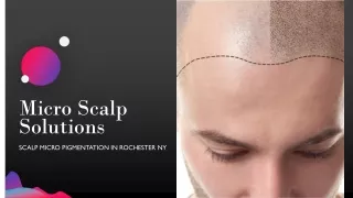 Go for the scalp micro-pigmentation in Rochester NYC treatment for your bald head