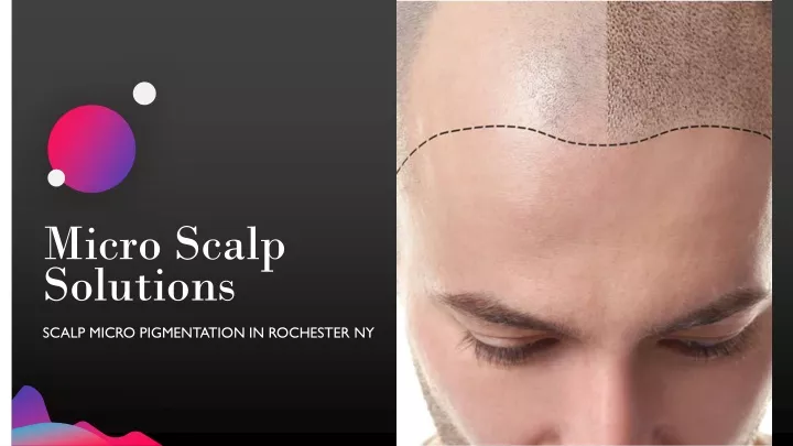 micro scalp solutions