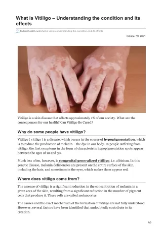 what is vitiligo understanding the condition