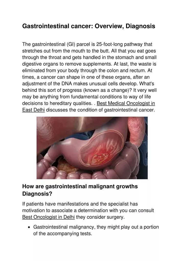 gastrointestinal cancer overview diagnosis