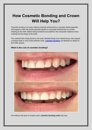 how cosmetic bonding and crown will help you