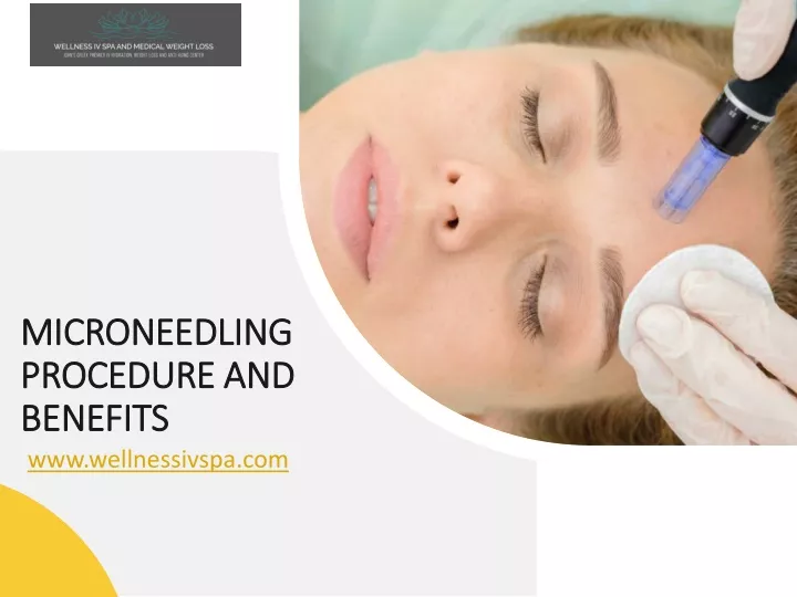 microneedling procedure and benefits