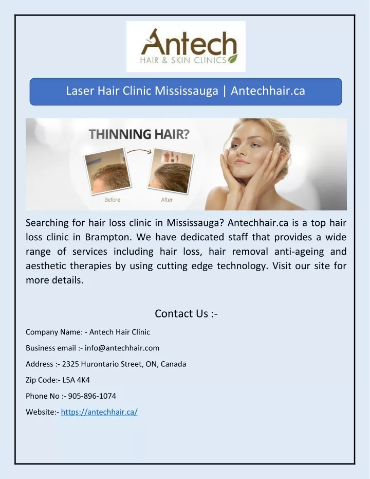 laser hair clinic mississauga antechhair ca