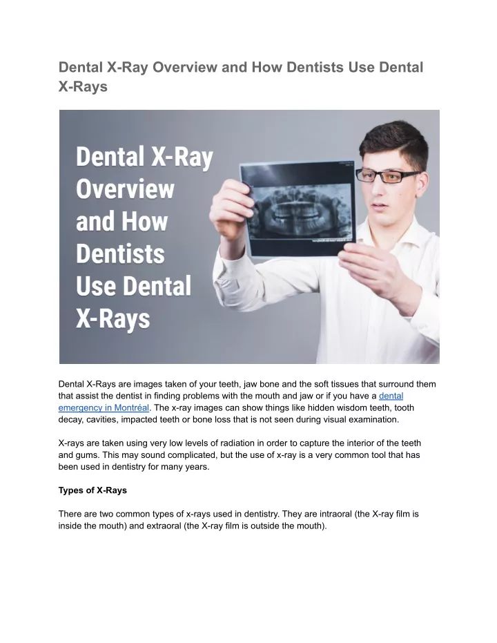 dental x ray overview and how dentists use dental