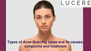 Types of Acne Scarring types and its causes, symptoms and treatment