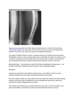 Paget’s bone disease- Symptoms and Treatment