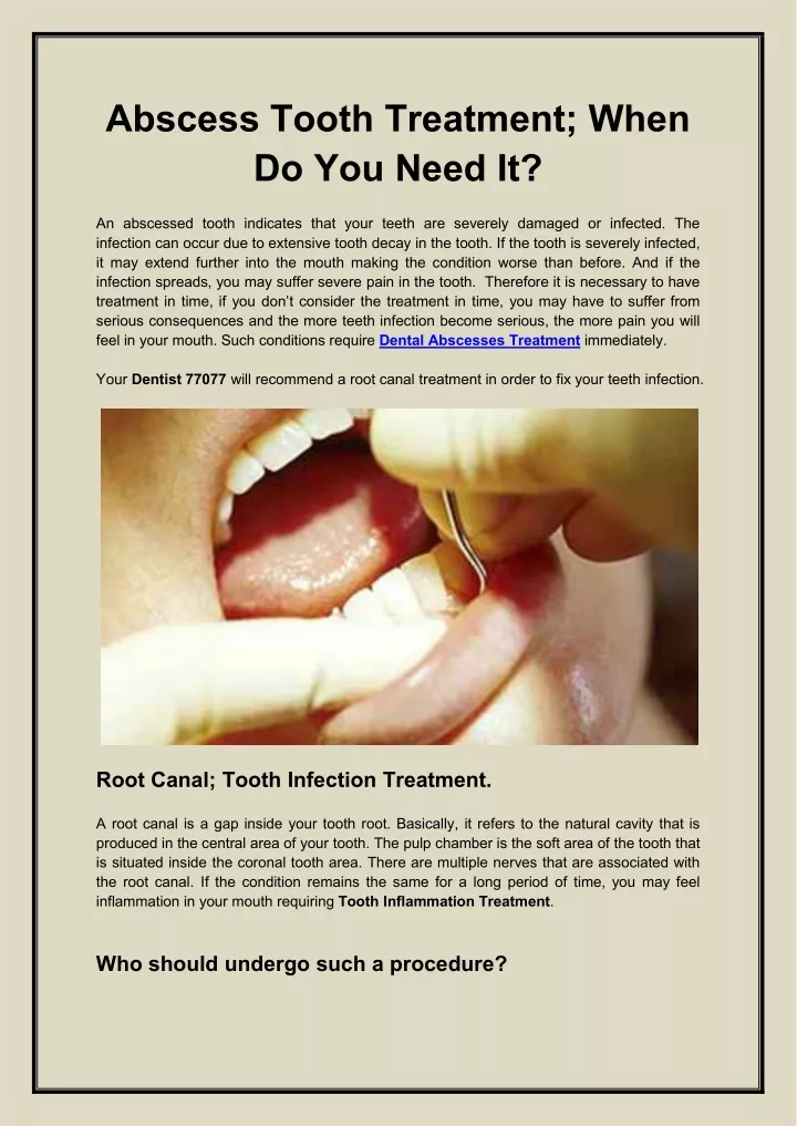 abscess tooth treatment when do you need it