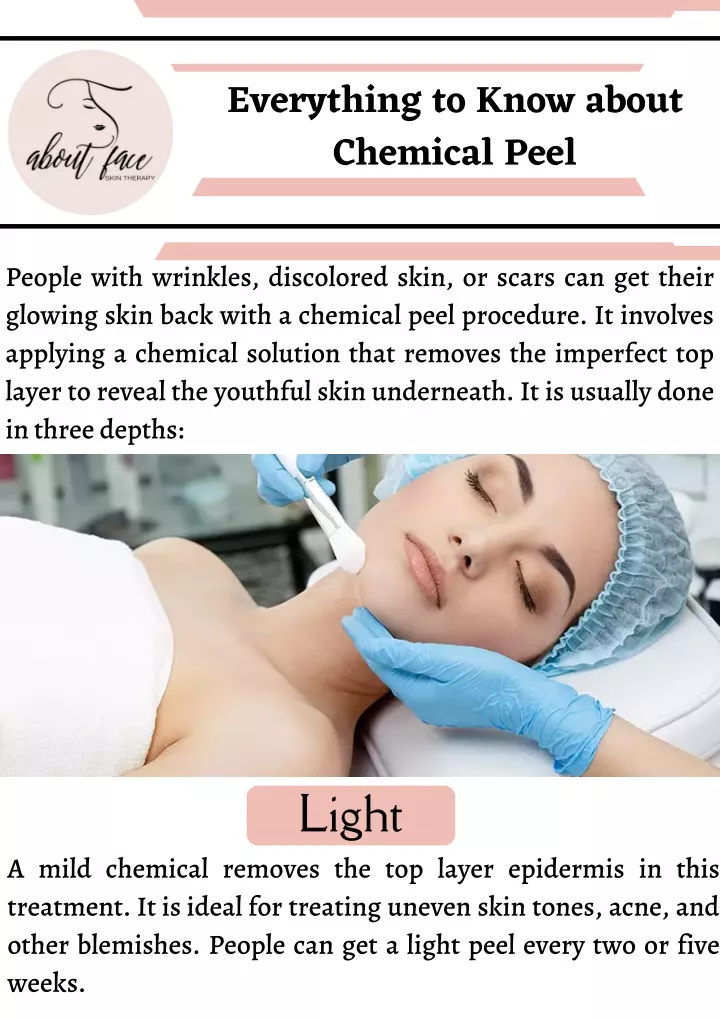 everything to know about chemical peel