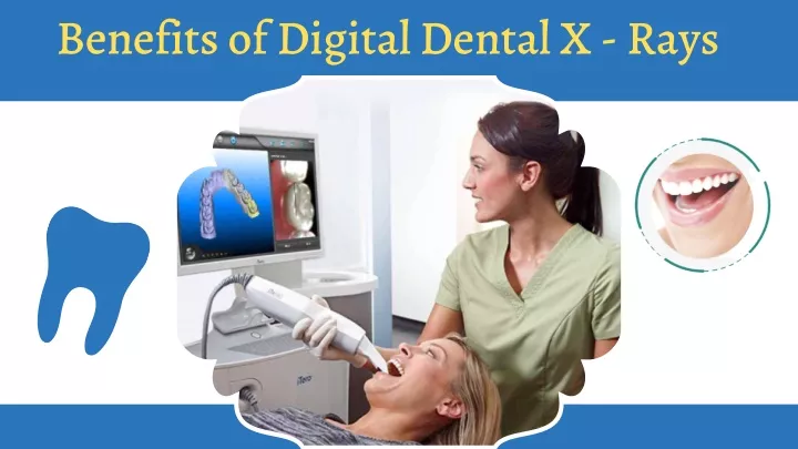 benefits of digital dental x rays