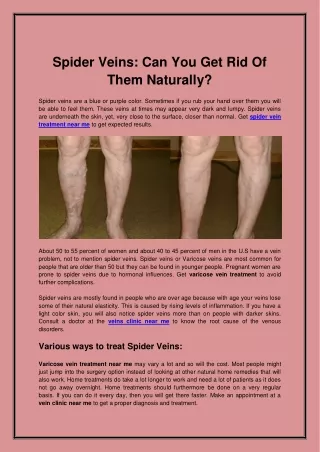 Spider Veins Can You Get Rid Of Them Naturally