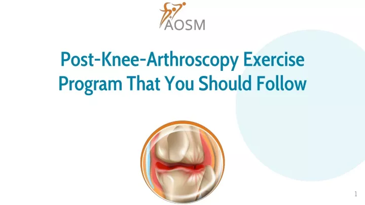 post knee arthroscopy exercise program that you should follow