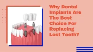 Dental Implants The Best Choice For Tooth Replacement