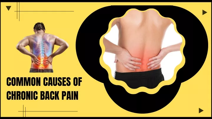 common causes of chronic back pain