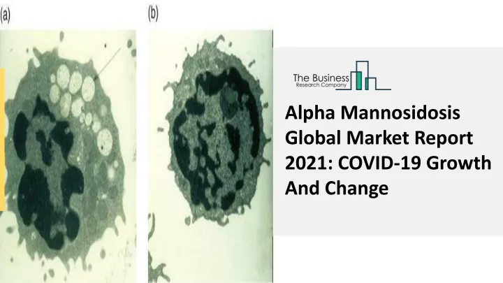 alpha mannosidosis global market report 2021