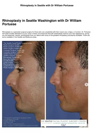 Nose Surgery in Seattle WA with Dr William Portuese