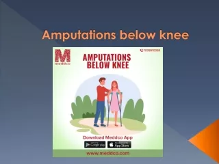 Amputations below knee