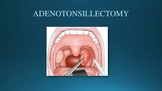 Adenotonsillectomy - Meddco
