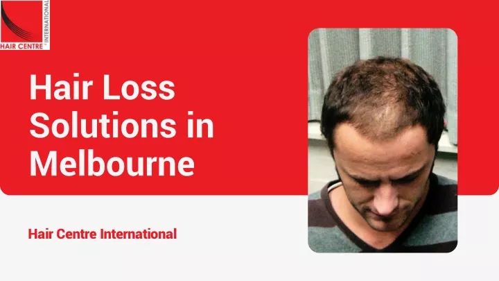 hair loss solutions in melbourne