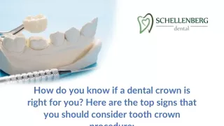 Signs You Need a Dental Crown - SchellenbergDental