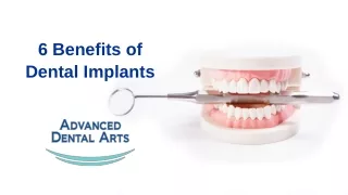 6 Benefits of Dental Implants - DrNathanielChan