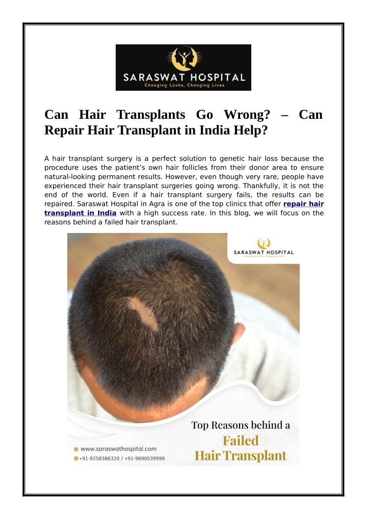 can hair transplants go wrong can repair hair