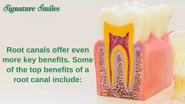 root canals offer even more key benefits some