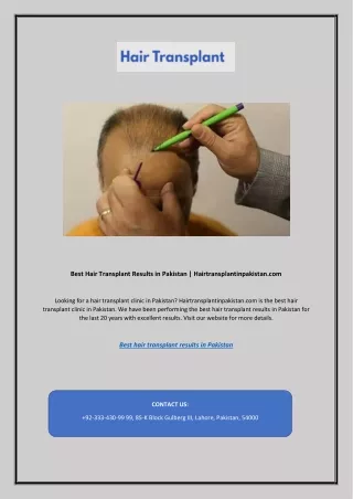 Best Hair Transplant Results in Pakistan | Hairtransplantinpakistan.com