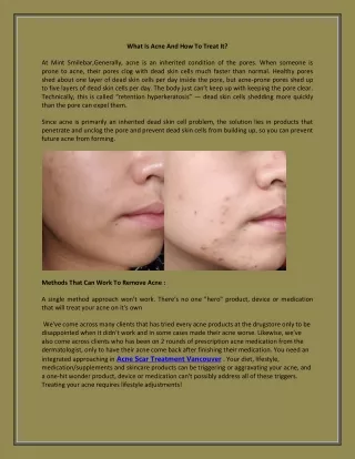What Is Acne And How To Treat It