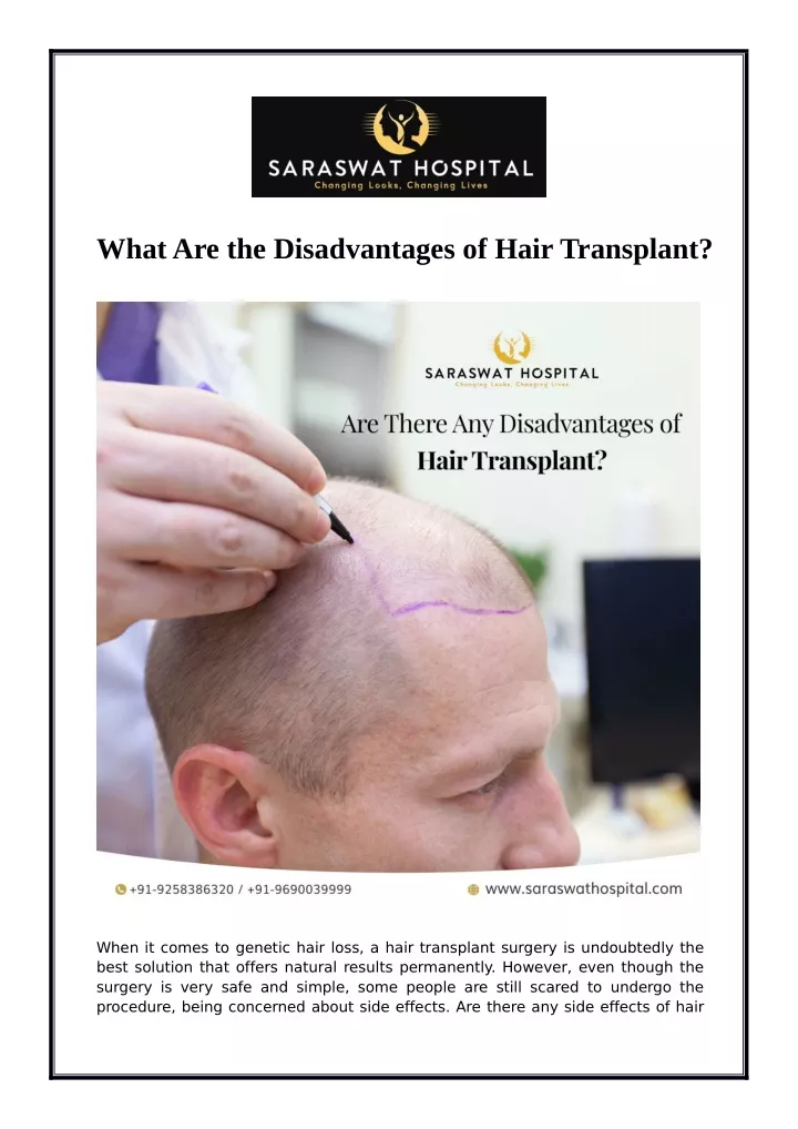 whatare the disadvantages of hair transplant