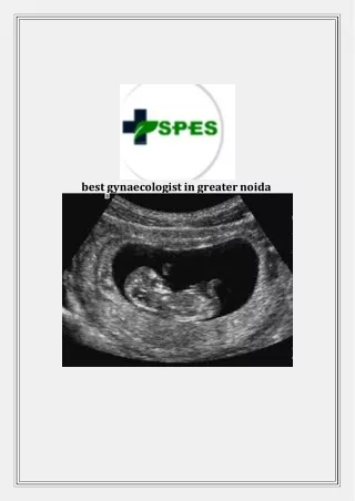 best gynaecologist in greater noida