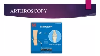 Arthroscopy - Meddco