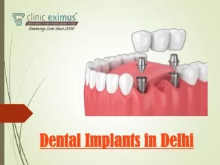How can Choose Dental Implants in  Delhi