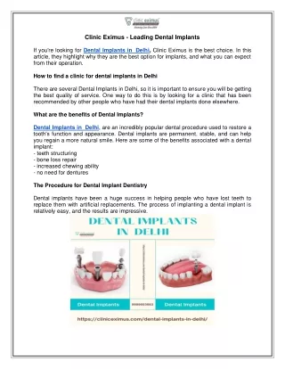 Looking for Dental Implants in  Delhi