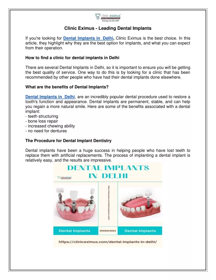 clinic eximus leading dental implants