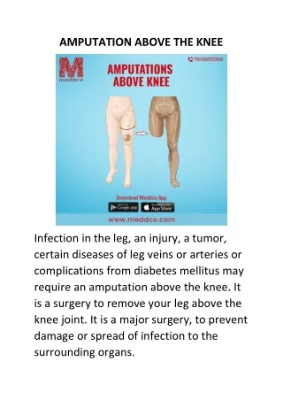 amputation above the knee